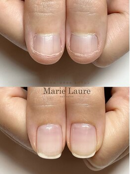 マリーロール 淀屋橋本店(Marie Laure)/自爪育成/深爪矯正/ネイルケア