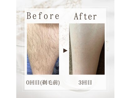 サロン ルイ(salonRui)の写真