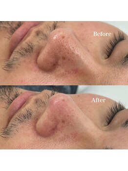 モテテ(motete)/お客様施術例☆栄本店