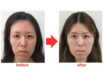 ブプラ 小倉店(BUPURA)/