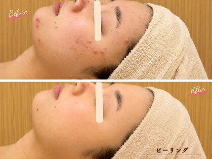 エピファニー(Epi phany Total Beauty Salon)の写真