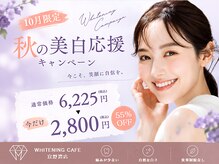 ホワイトニングカフェ 宜野湾店(WhiteningCafe)