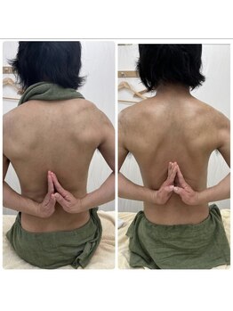 ソルニス(Solnis.)/痩身☆脂肪分解/ハイパーナイフ