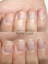 マリーロール 淀屋橋本店(Marie Laure)/自爪育成/深爪矯正/ネイルケア