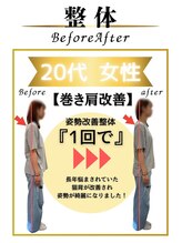 みなもと整骨院/20代　巻き肩