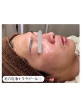 エ リンダ(E- LINDA)/ララピール