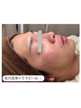 エ リンダ(E- LINDA)/ララピール