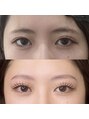 アンリー 栄店(UNLY)&nbsp;[骨格眉]自分の顔に馴染む唯一無二の眉毛WAXを提供します◎