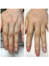 エルナ(elna)/憧れの美爪変身！