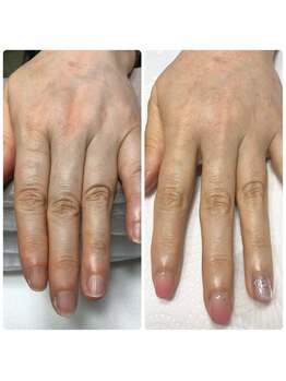 エルナ(elna)/憧れの美爪変身!