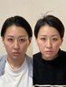 本格★【ゴツゴツ顔・大きい顔なんとかしたい】滑らかな卵形/施術60分/¥7700
