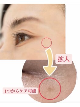 ケーエピ 長居(K-epi)の写真/効果的なエイジングケアで今より若々しいお肌を実現♪早期結果に努めた施術をご提案♪≪シミ・しわケア◎≫