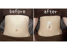 エルア(2 elua)/半身アロマリンパ（上半身）