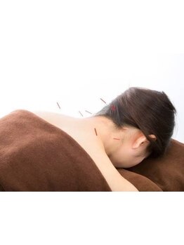 鍼灸施術を受けたい