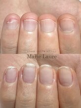 マリーロール 淀屋橋本店(Marie Laure)/自爪育成/深爪矯正/ネイルケア