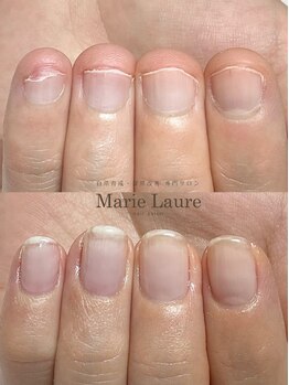 マリーロール 淀屋橋本店(Marie Laure)/自爪育成/深爪矯正/ネイルケア