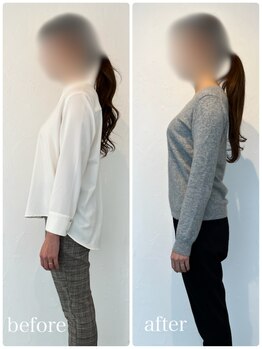 キトウミ(kitoumi)/before after