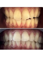 スマイルラボ 金沢店/ビフォー/アフター