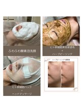 ネリネ(Nerine)/ハーブピーリング