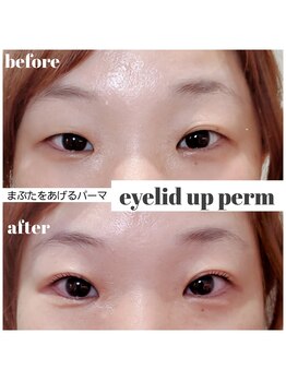 コトリ(kotori)/アイリッドアップパーマ