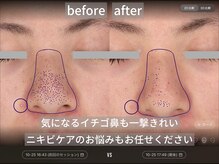 毛穴には多角的にアプローチ。