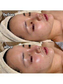 リボーン(be reborn)/肌本来の力を高めて