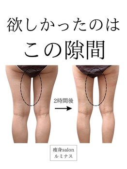 ルミナス/脚ラインを整えたい方へ