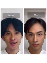 ハッピーアリスター(HAPPY ALISTER)/メンズメイクビフォーアフター☆