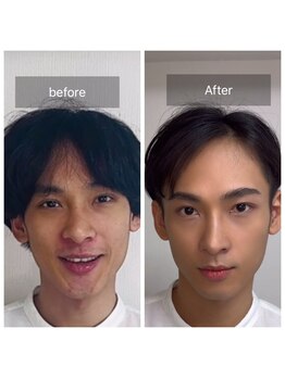 ハッピーアリスター(HAPPY ALISTER)/メンズメイクビフォーアフター☆