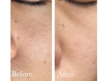 MMK/毛穴が目立たないクリア肌へ♪