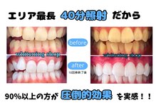 ホワイトニングショップ 三島店(WHITENING SHOP)