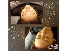 美容鍼や身体調整鍼ふございます