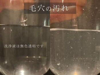 ダリア(Dahlia)/毛穴洗浄【before/after】