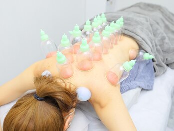 エース(A)の写真/【大網エリア希少!】本気で改善したい方へ!慢性疲労/首肩コリ/腰痛に◎吸玉筋膜スライドカッピング60分~