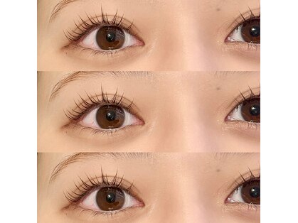 ユラ(Yura)の写真