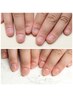 【HAND】深爪.自爪育成.他店でお断りの爪大歓迎♪店長担当☆自然な爪へ変身♪