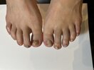 フットネイル