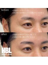わたしいろ/HBLビフォーアフター