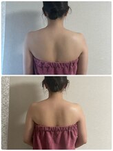 ブリランテ(Brillante)/体験beforeafter背中