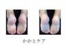かかとケア★ガサガサのかかとをツルツルにします