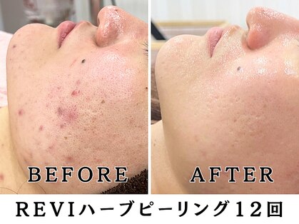 レヴィア(Revia)の写真