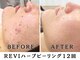 レヴィア(Revia)の写真