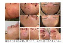 美しぐれ 溝の口店