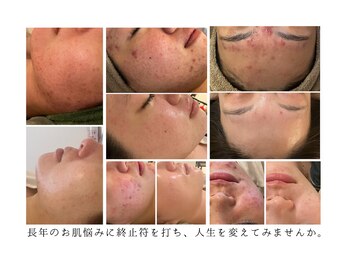 美しぐれ 溝の口店