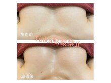 タイカ(Taika)の雰囲気（2カップ実績☆エビデンス取得バスト♪理想のバストが目指せる◎）