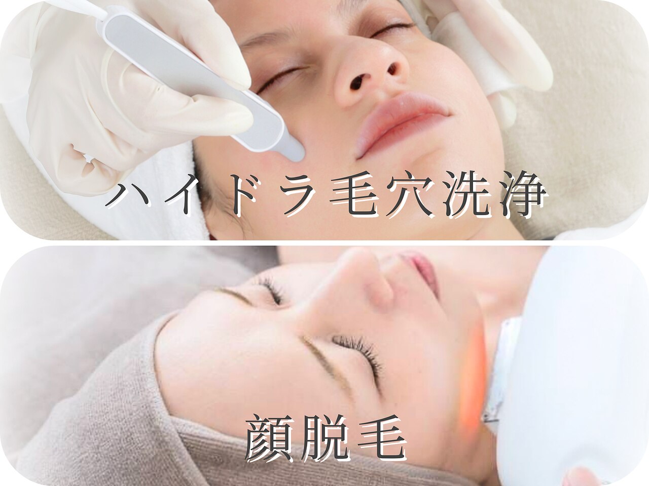 西18丁目駅で光フェイシャルが人気のエステサロン｜ホットペッパー