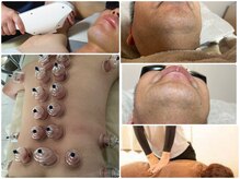 シャイニースキン(Shiny skin)