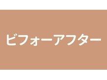 ヨサパーク ヒスイ 桜新町(YOSA PARK)/ビフォーアフター