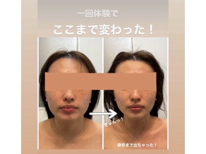 ベル(belle)の写真
