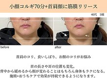 ペルク(perk)/小顔コルギ70分